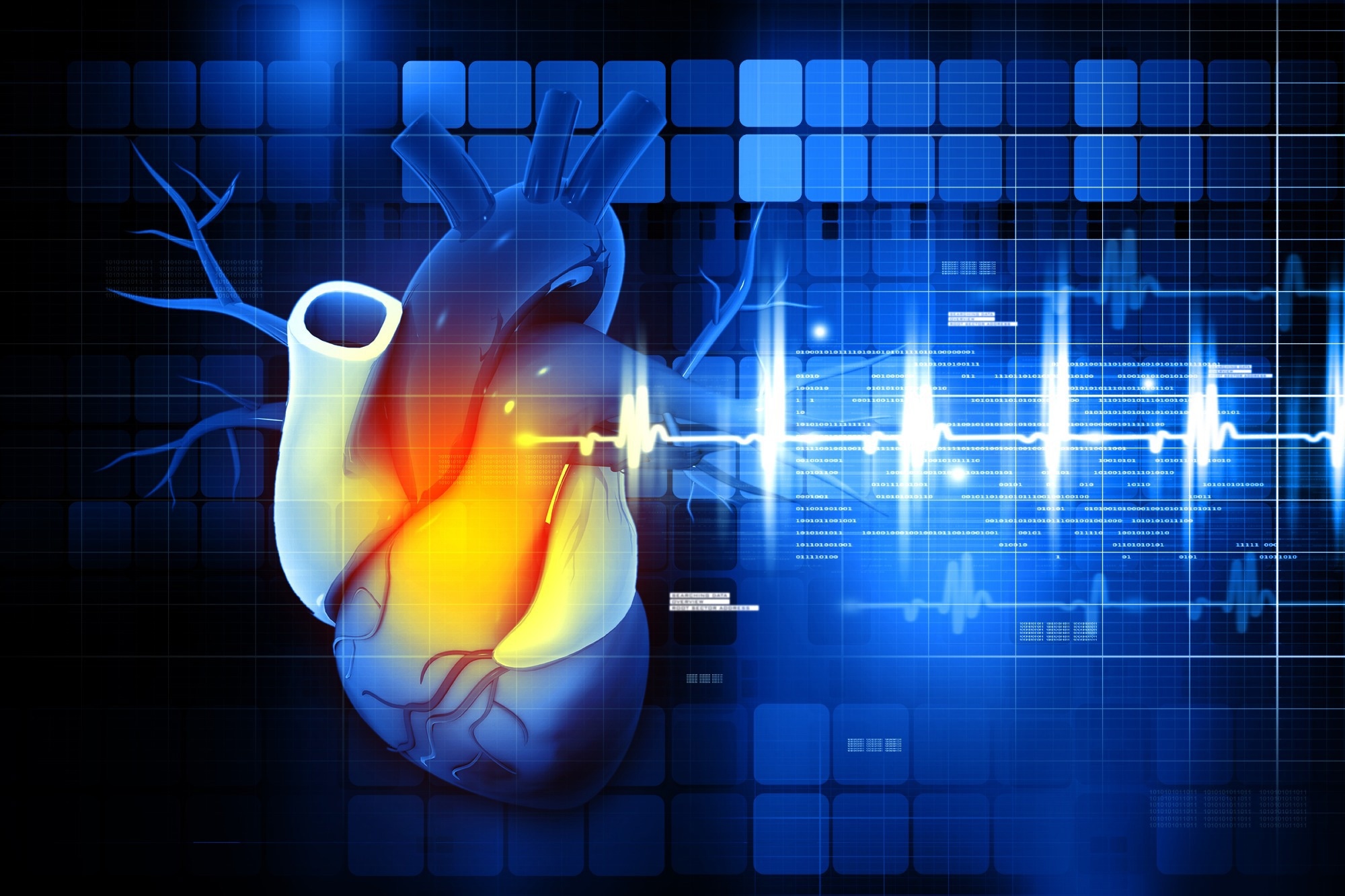 Study: Rare and common genetic variation underlying atrial fibrillation risk.  Image credit: hywards / Shutterstock